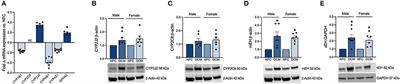 Changes in the Left Ventricular Eicosanoid Profile in Human Dilated Cardiomyopathy